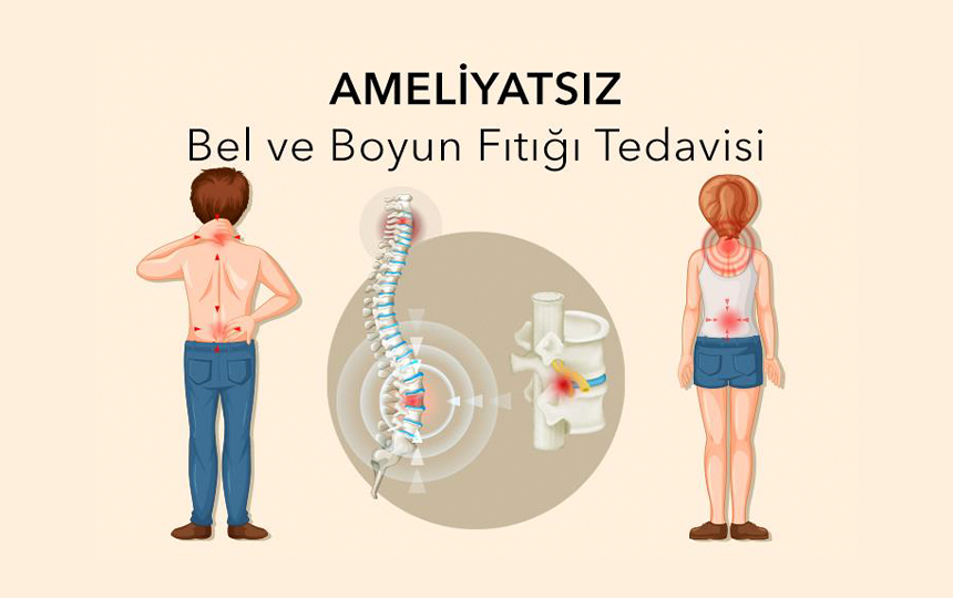 Ameliyatsız Bel ve Boyun Fıtığı Tedavisi - Nokta Atışı