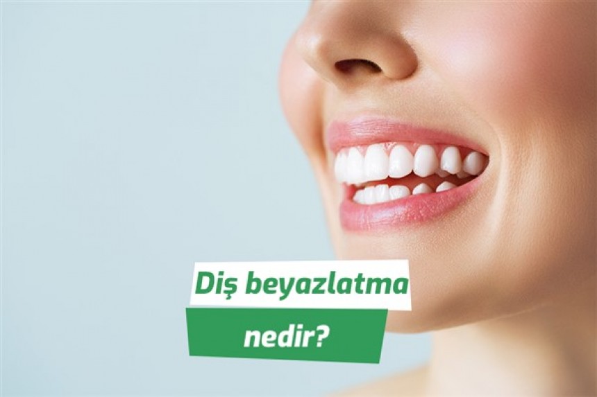 Diş beyazlatma nedir?