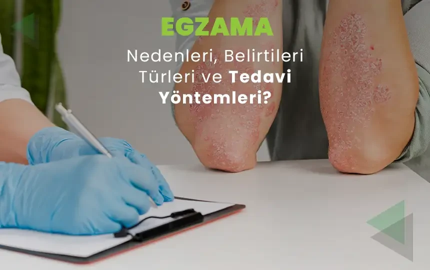 Egzama (Atopik Dermatit) Nedir? Belirtileri, Nedenleri ve Tedavi Yöntemleri