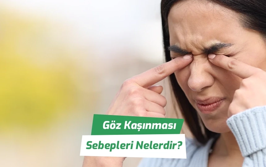 Göz kaşınması sebepleri nelerdir?