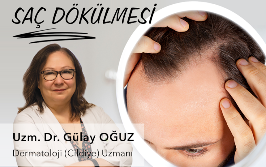 Saç Dökülmesi Nedir?