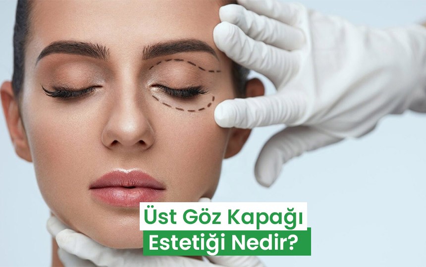 Üst göz kapağı estetiği nedir?